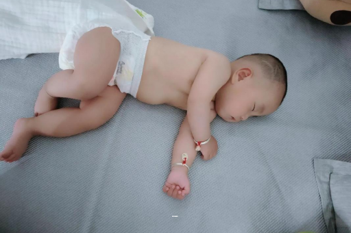 包头孕妇前庭大腺囊肿